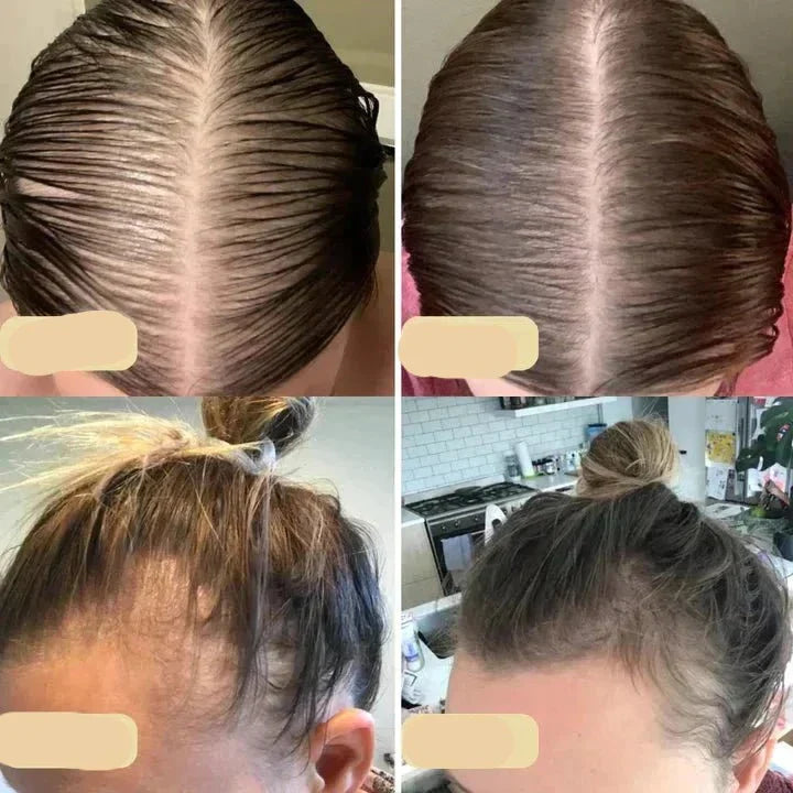 Vorher-Nachher-Bilder Haarwachstum, vegane Haaröl-Anwendung, Kopfhaut, Haarverdichtung.